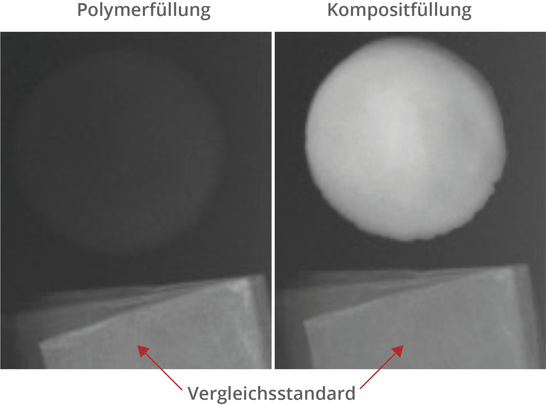 Abbildung 3: Verbesserung der Sichtbarkeit von Zahnfüllungen im Röntgenbild.