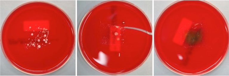 Abbildung 5: Abklatschtest von behandelten Schweineohren auf Agarplatten – Bakterienbefall durch weißliche Kulturen gekennzeichnet. 

links: Referenztest mit Wasser 

mittig: 0,25M MFx-Desinfektionslösung 

rechts: 1M MFx-Desinfektionslösung 


